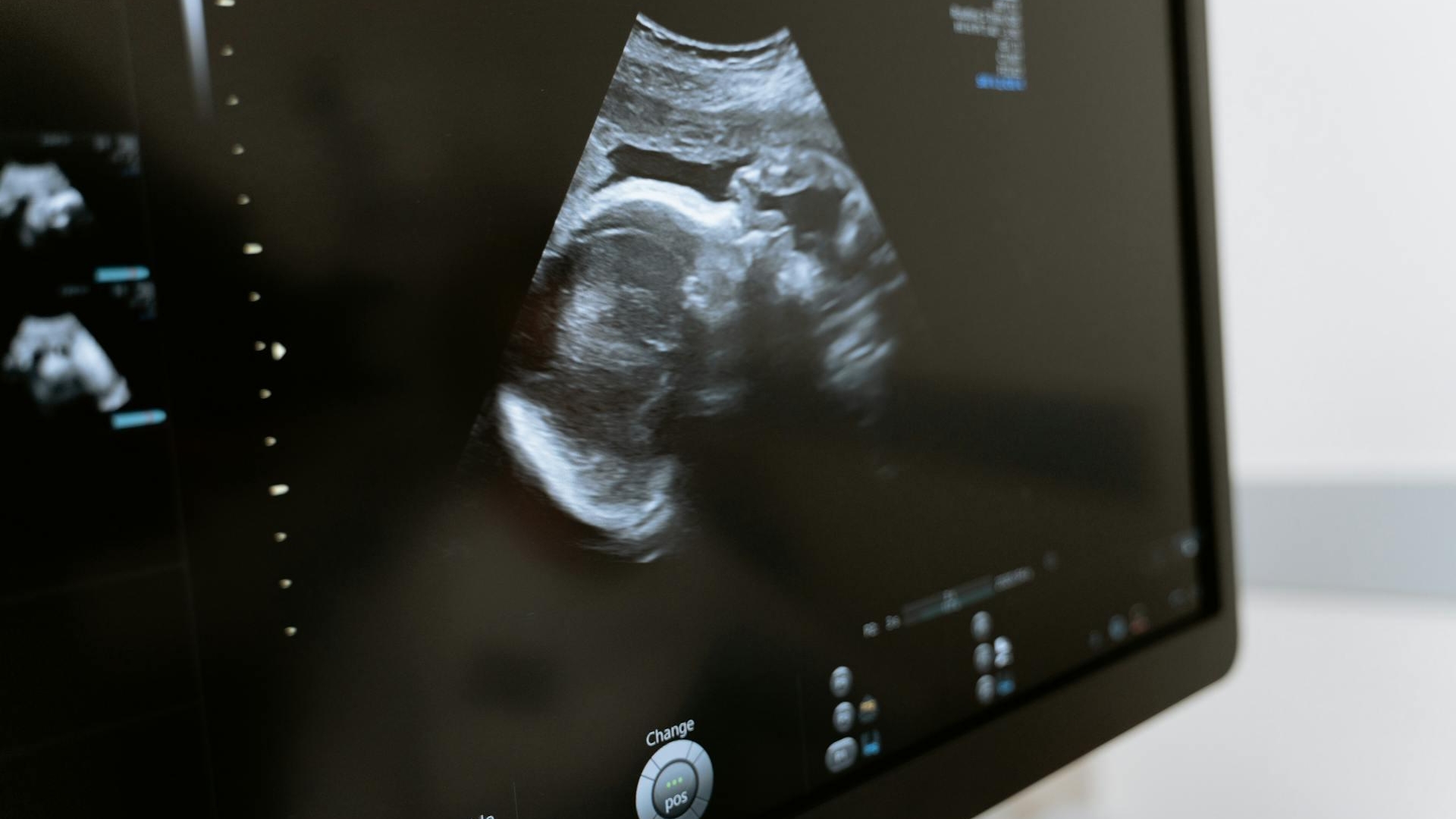 L’échographie obstétricale, un repère essentiel dans le suivi de la grossesse !